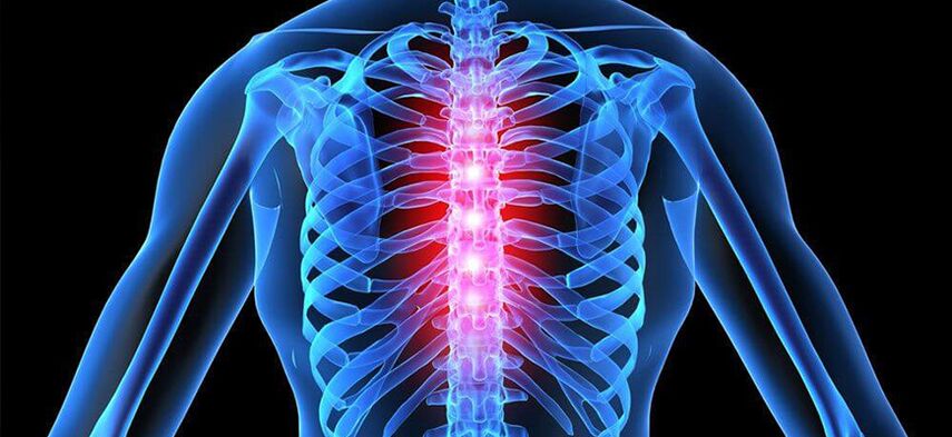 Обостряне на остеохондроза на гръдния кош