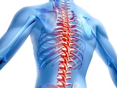 лезия на гръбначния стълб с остеохондроза