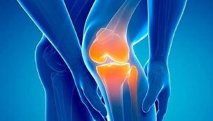 артроза на коляното
